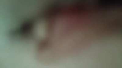 camera attack it is