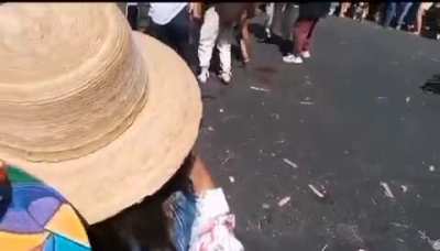 Man's hand blown off by a cannon during a parade