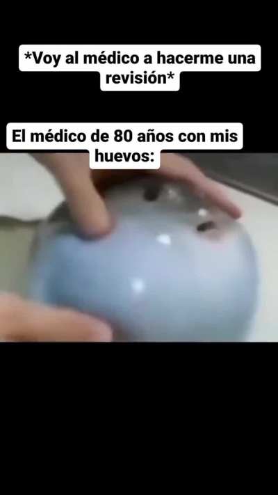 yo_ctm
