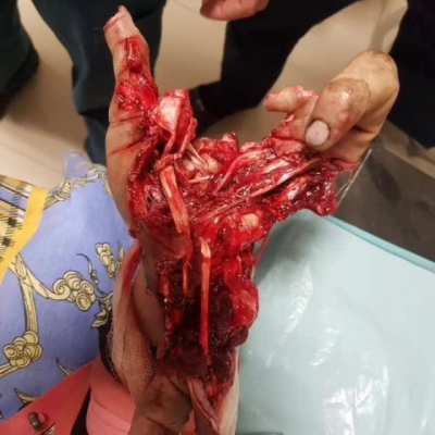 Be careful with fireworks on New Year's Eve guys