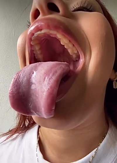 Omg