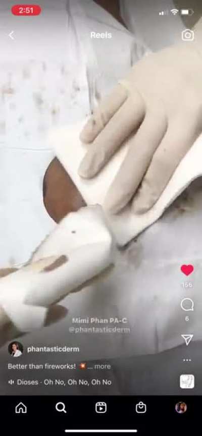 Нямка
