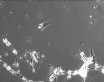 What it looks like when apes gain a wrinkle from DD. 🧠