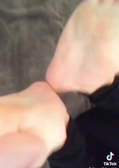 White toes 