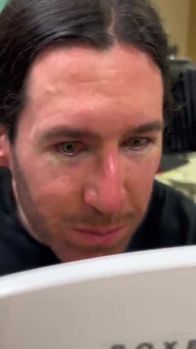 Man gets his eye colour surgically changed