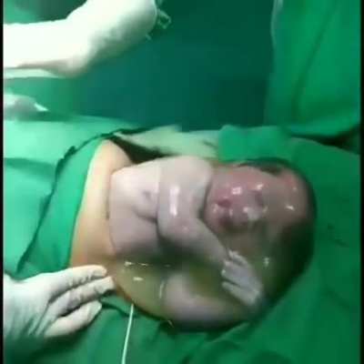 Unassisted C-section delivery en caul