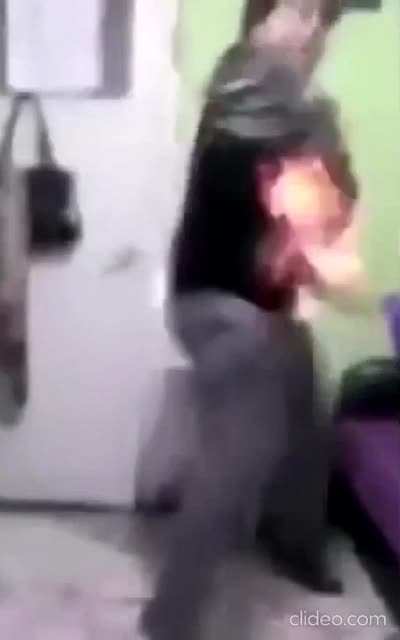 Turkish Boy Burns His Back And Arm