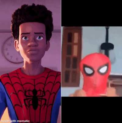Where did his hair go?