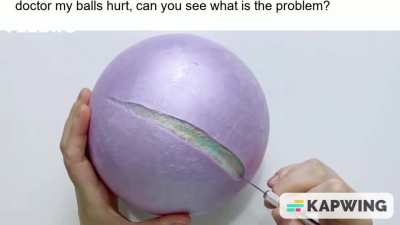 nooooo not my ball children
