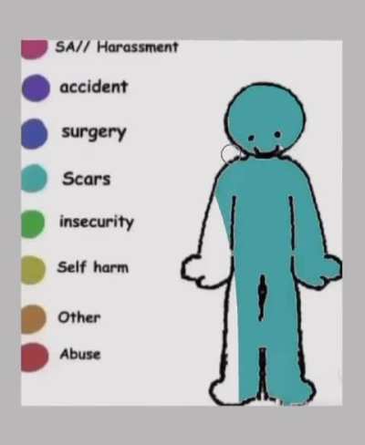 😔