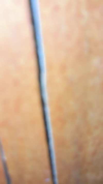 (Surface?)Cracked post at gate options?? Carriage bolts??