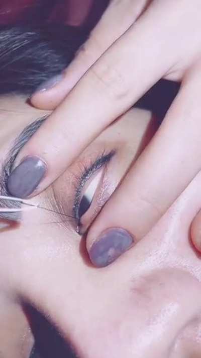 Hairy eye ball