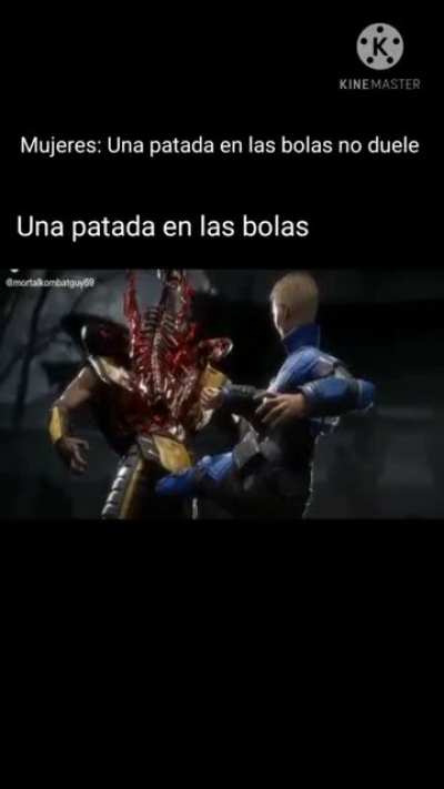 No duele, decían