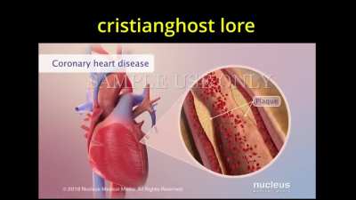 Es chistoso porque los watones se mueren