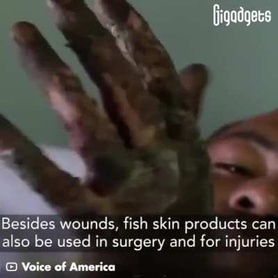 “This fish skin bandage brings new hope to the treatment of burn wounds. Researchers from all over the world have been developing and testing this treatment for years.”