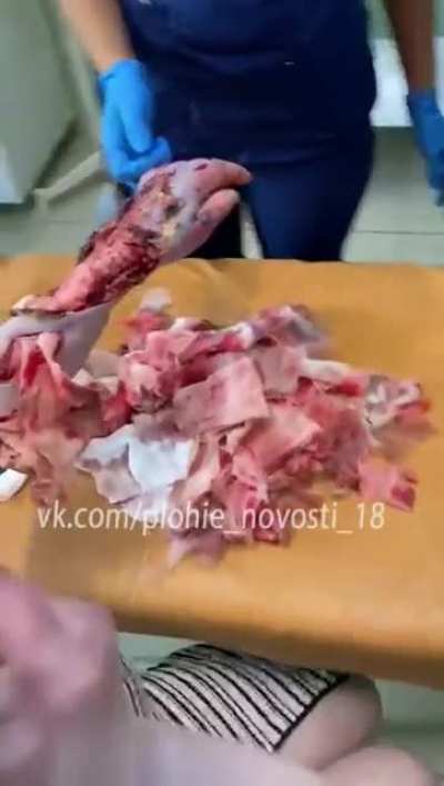 Прислала видео, снятое сегодня в одной из красноярских больниц. Наркоманка рассказала, что вколола в руку соль 4 дня назад и что-то пошло не так. Ps( если это через чур и вам не нравится то минусите или пишите в коменты, просто интересно узнать стоит выкл