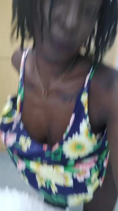 Massive mammaries