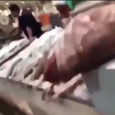 Shiet