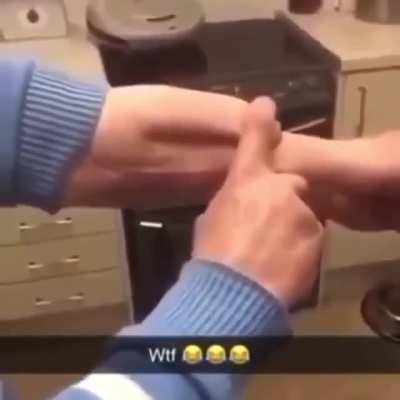 Penis on his arm