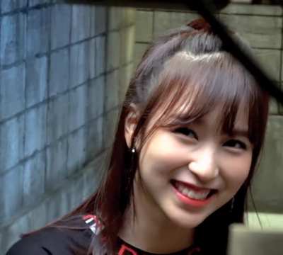 This gummy smile!