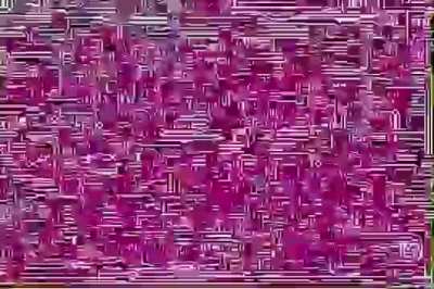the epilpsy 2