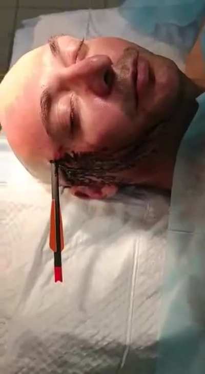 Russian man with a crossbow bolt through the side of his head talking with the doctor [NSFW]
