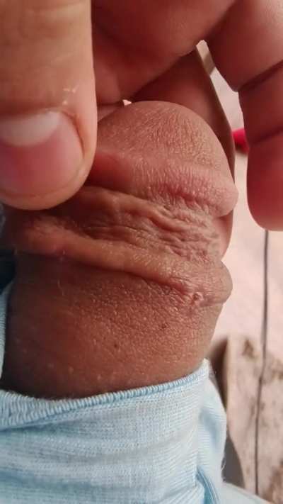 What is this loose under skin?