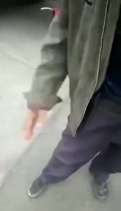 Blursed_Finger