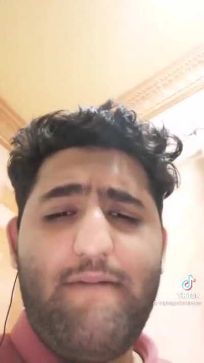 Hair loss :(