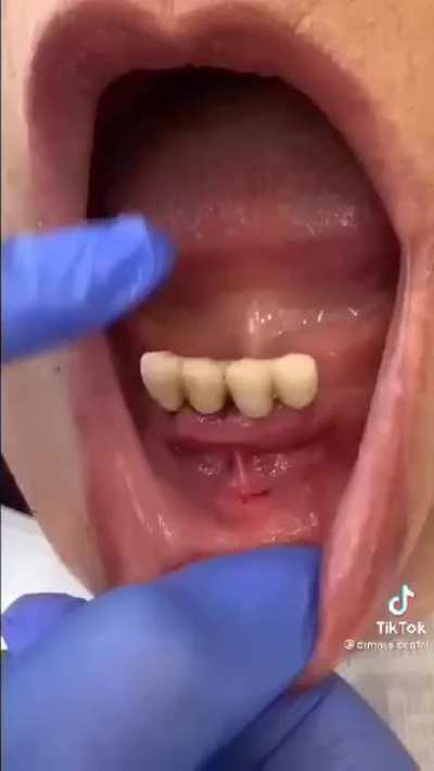 What the fuck