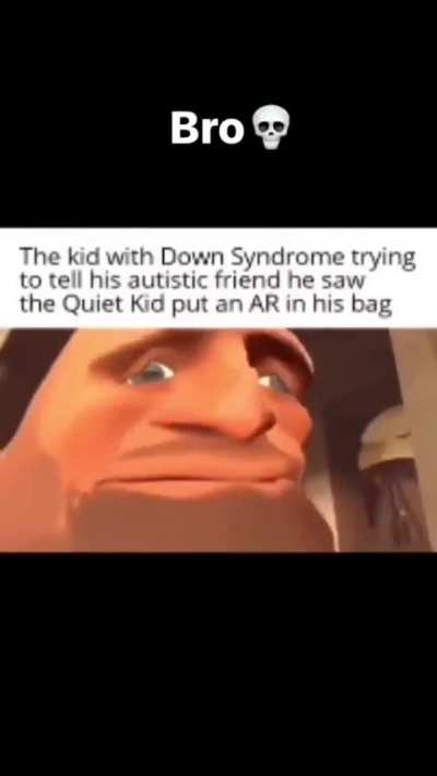Bro 💀