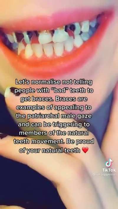TW: Disgusting