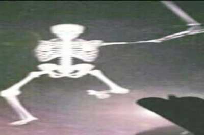 Skeletron Fight Be Like...