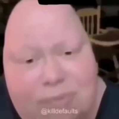 Egg lookin assed bitch