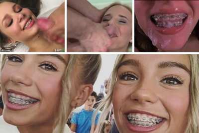Lisa and Lana with braces - IG