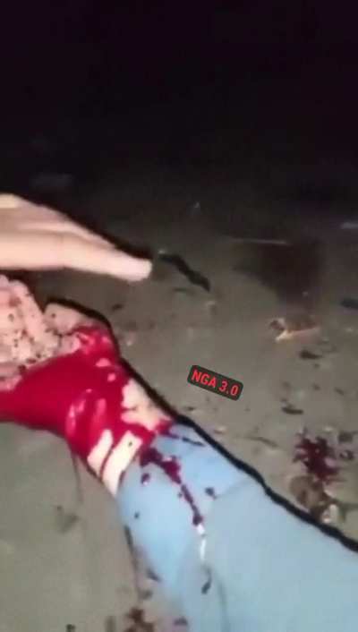 [LFO] Fool smashes a glass bottle with his bare hand and hits an artery