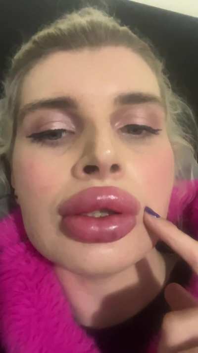 Lips so big my mouth is always open