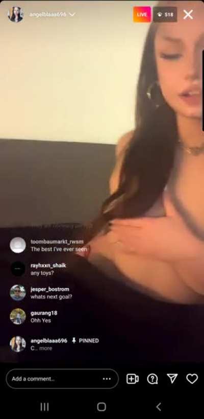 live rn