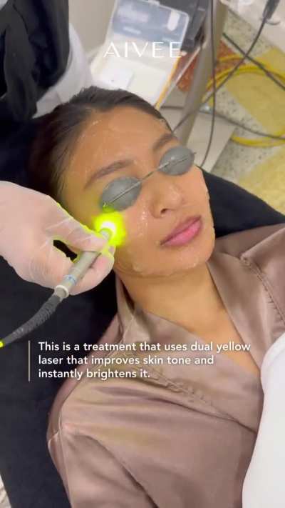 Nadine Lustre