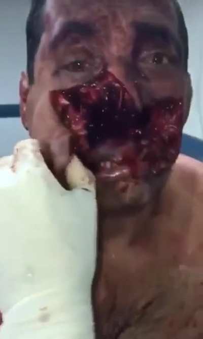 Extreme nsfw