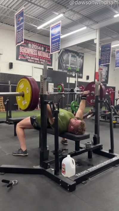 Gym bro drops weights on his head