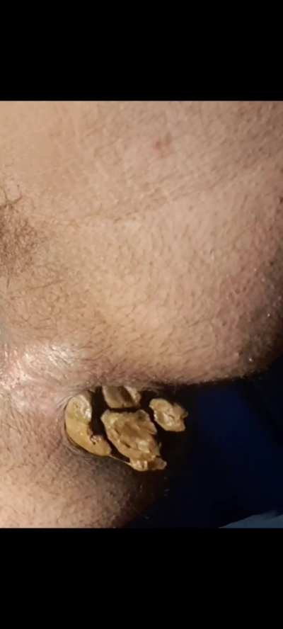 (F) huge turd for u