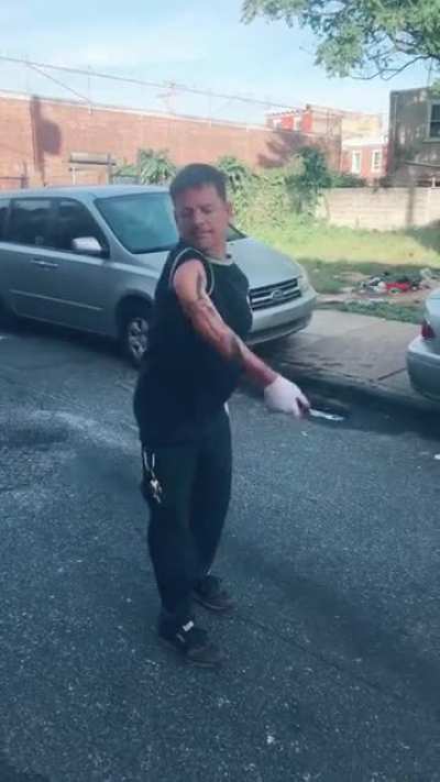 What happened to Michael J Fox's arm?
