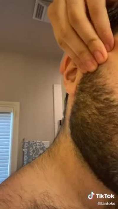 It will grow back