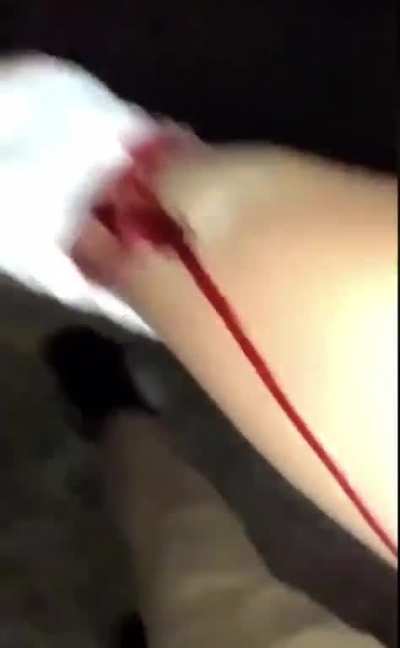 Police shoots protestor for no reason