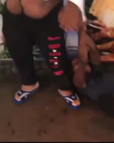she bit the fuck out him???