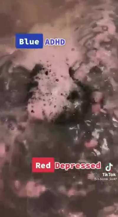 I heard red though...