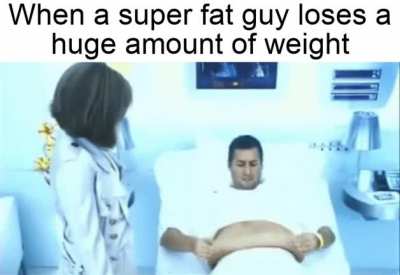 Saw a video of a fat guy lose weight, this is actually real
