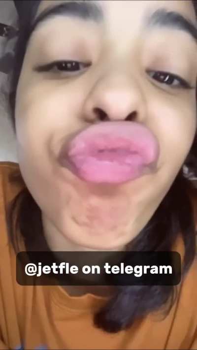 wet mouth 
