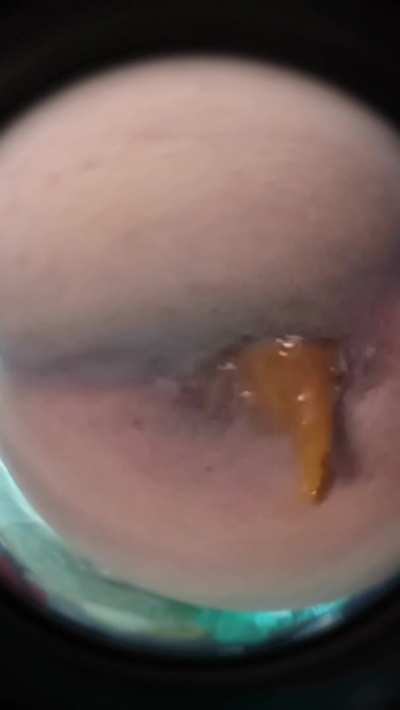 [f] Open up wide and eat it all